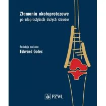 Złamania okołoprotezowe po aloplastykach dużych stawów | - Książki medyczne - miniaturka - grafika 1