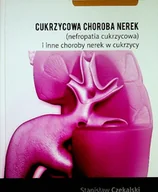 Książki medyczne - Cukrzycowa choroba nerek - miniaturka - grafika 1
