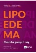 Książki medyczne - Lipoedema. Choroba grubych nóg. Podejście interdyscyplinarne - miniaturka - grafika 1