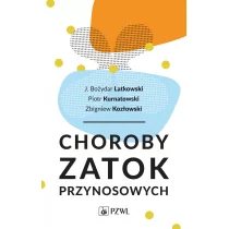 Choroby zatok przynosowych - Zdrowie - poradniki - miniaturka - grafika 1