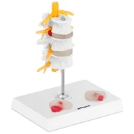 Mały naukowiec - Model anatomiczny 3D odcinka lędźwiowego kręgosłupa z przepukliną kręgi 3-5 - miniaturka - grafika 1