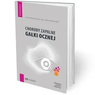 Książki medyczne - Choroby zapalne gałki ocznej - poradnik lekarza pr - praca zbiorowa - miniaturka - grafika 1