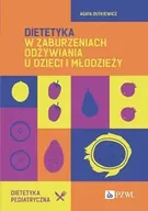 Technika - Dietetyka w zaburzeniach odżywiania u dzieci i młodzieży - Agata Dutkiewicz - miniaturka - grafika 1