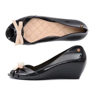 Baleriny - Lu Boo Czarne Gumowe Lakierowane Balerinki Meliski Sense - ButyModne - miniaturka - grafika 1