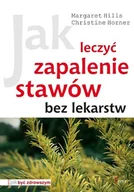 Zdrowie - poradniki - Jak leczyć zapalenie stawów bez lekarstw - miniaturka - grafika 1