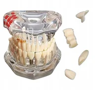 Czasopisma - MODEL STOMATOLOGICZNY LUDZKIEJ SZCZEKI UZEBIENIA ZĘBÓW IMPLANT ZĄB ZĘBY - miniaturka - grafika 1
