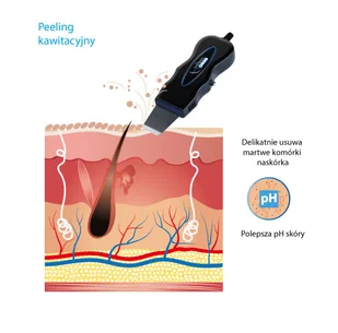 Alvi Prague Urządzenie do peelingu kawitacyjnego T-02 - Pozostałe urządzenia kosmetyczne - miniaturka - grafika 6
