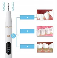 Irygatory do zębów - SKALER ULTRADŹWIĘKOWY DENTYSTYCZNY DO ZĘBÓW MOCNY USUWANIE KAMIENIA - miniaturka - grafika 1