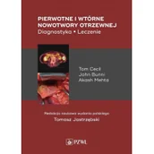 Książki medyczne - Pierwotne i wtórne nowotwory otrzewnej Cecil Tom Bunni John Mehta Akash - miniaturka - grafika 1
