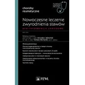 Książki medyczne - Jabłoński Mirosław, Blicharski Tomasz Nowoczesne leczenie zwyrodnienia stawów. Mini-interwencje zabiegowe - miniaturka - grafika 1