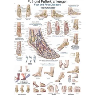 Tablica anatomiczna - Stopa i jej choroby (ENG/DE) - 70x100 cm - Mapy i plansze edukacyjne - miniaturka - grafika 1