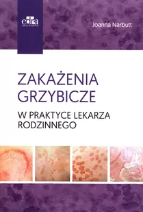 Zakażenia grzybicze w praktyce lekarza rodzinnego - Książki medyczne - miniaturka - grafika 1