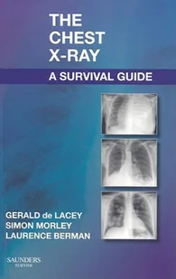 Elsevier Saunders Chest X-Ray: A Survival Guide - Pozostałe książki - miniaturka - grafika 2