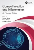 Pozostałe książki - Corneal Infection and Inflammation: A Colour Atlas - miniaturka - grafika 1