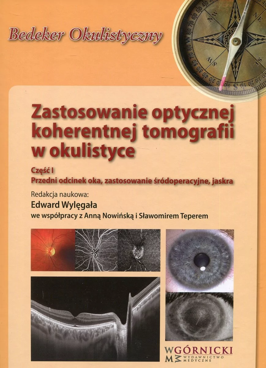 Zastosowanie optycznej koherentnej tomografii w okulistyce Czę$299ć 1