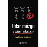 Biznes - Udar mózgu u dzieci i młodzieży | ZAKŁADKA DO KSIĄŻEK GRATIS DO KAŻDEGO ZAMÓWIENIA - miniaturka - grafika 1