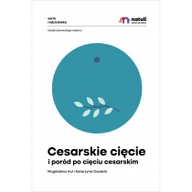 Poradniki dla rodziców - Cesarskie cięcie i poród po cięciu cesarskim - miniaturka - grafika 1