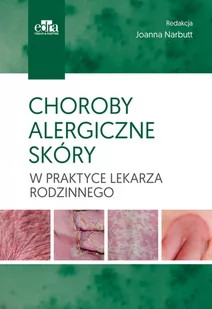 Urban &amp; Partner Choroby alergiczne skóry w praktyce lekarza rodzinnego - Literatura popularno naukowa dla młodzieży - miniaturka - grafika 1