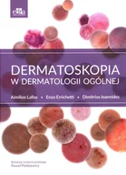 Książki medyczne - dermatoskopia w dermatologii ogólnej - miniaturka - grafika 1