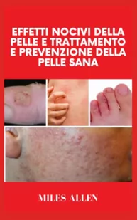 EFFETTI NOCIVI DELLA PELLE E TRATTAMENTO E PREVENZIONE DELLA PELLE SANA - Oferty nieskategoryzowane - miniaturka - grafika 1