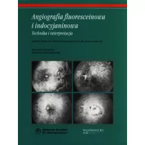 Angiografia fluoresceinowa i indocyjaninowa - Berkow Joseph W., Flower Robert W., Orth David H., Kelley James S. - Książki medyczne - miniaturka - grafika 1
