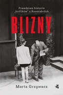 E-booki obcojęzyczne - Blizny. Prawdziwa historia "królików" z Ravensbruck - miniaturka - grafika 1