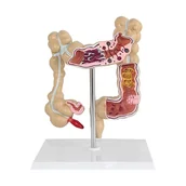 Mały naukowiec - Model jelita grubego - miniaturka - grafika 1