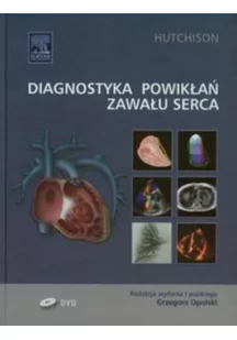 Urban & Partner Diagnostyka powikłań zawału serca - Hutchison Stuart J. - Książki medyczne - miniaturka - grafika 2
