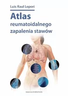 Książki medyczne - DK Media ATLAS REUMATOIDALNEGO ZAPALENIA STAWÓW - miniaturka - grafika 1