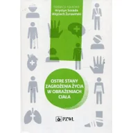 Książki medyczne - Ostre stany zagrożenia życia w obrażeniach ciała - miniaturka - grafika 1