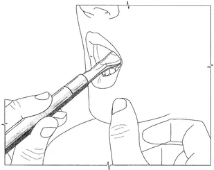 Spoon Tip XXL końcówka masująca do wibratora, do głoski R, (twarda gładka) - Akcesoria medyczne - miniaturka - grafika 3