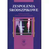 Wydawnictwo Lekarskie PZWL Zespolenia śródszpikowe - Szymon Gaździk - Książki medyczne - miniaturka - grafika 1