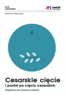 Miłość, seks, związki - Cesarskie cięcie i poród po cięciu cesarskim - miniaturka - grafika 1