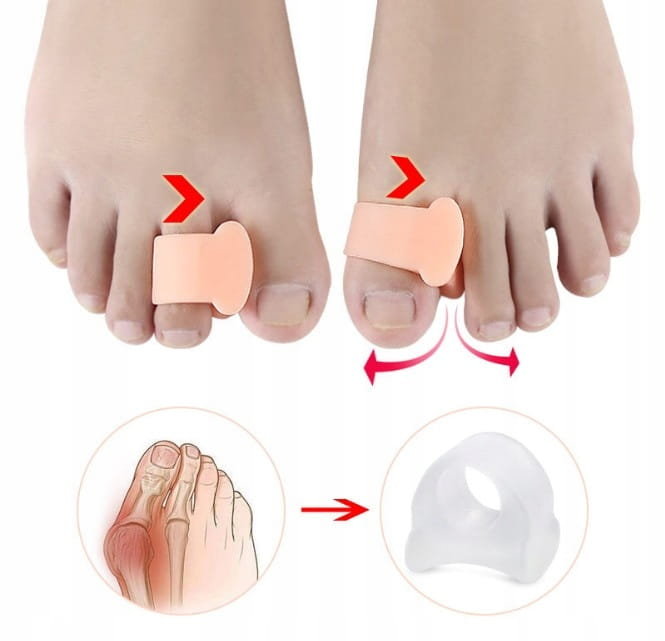 KLINY NA HALUKSY Z PIERŚCIENIEM CIELISTE rozm S