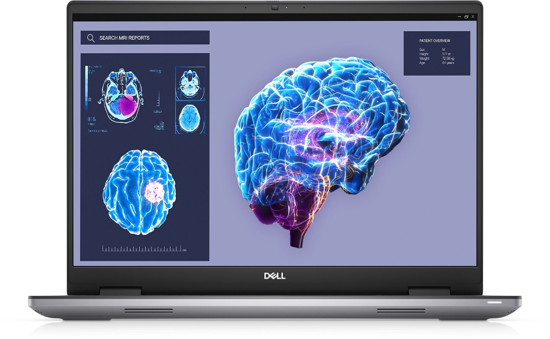 DELL Precision 7680 16 FHD+ i7-13850HX 64GB 1TB SSD + 2TB SSD RTX2000 FPR SCR BK W11P 3YPS