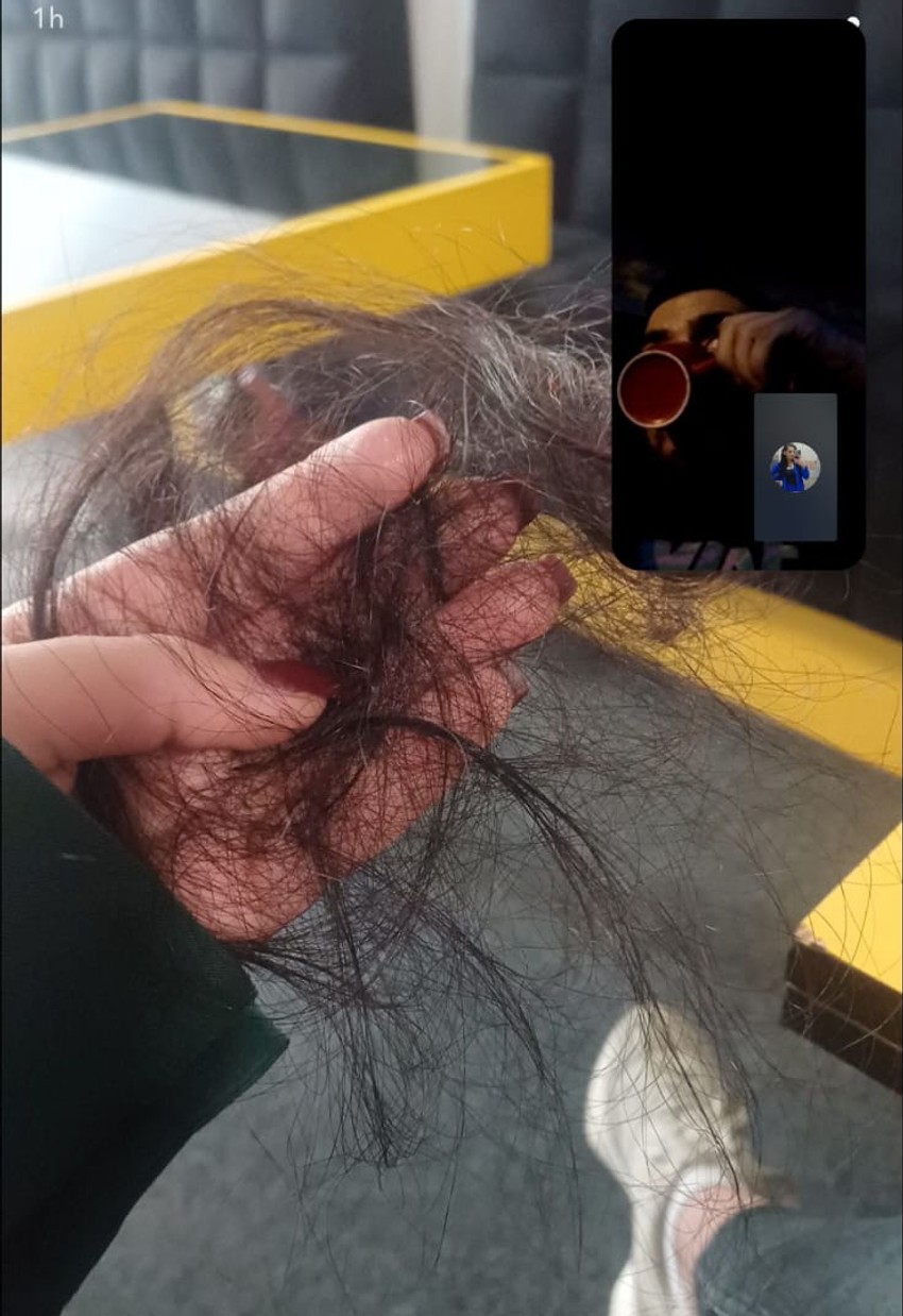 Pretučenoj Dejani otpala kosa nakon napada u Beranama