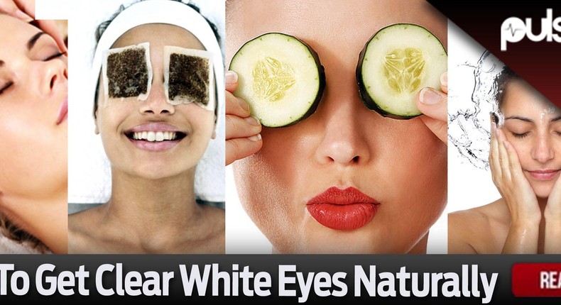 How to get clear white eyes naturally