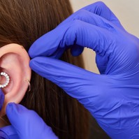 Migrén piercing: ennyit használ valójában a neurológus szerint