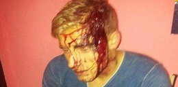 Angielski piłkarz zaatakowany siekierą