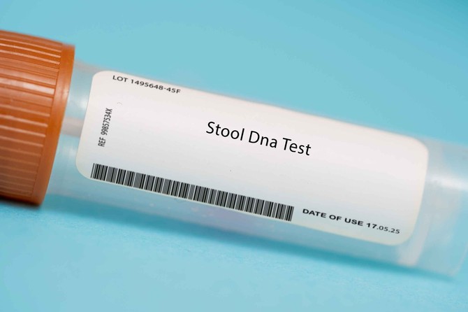 DNK test nedvosmisleno je pokazao da Drago nije Lukin otac