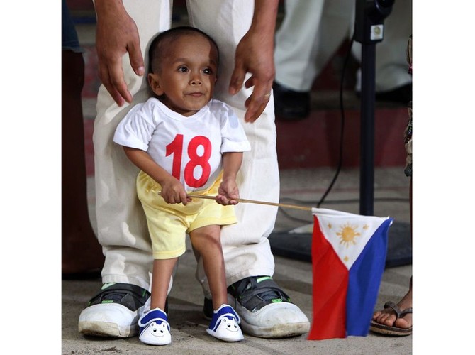 Maleńki Filipińczyk przestał rosnąć, gdy miał dwa lata