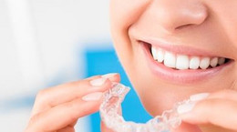 Jak działa aparat ortodontyczny Invisalign?