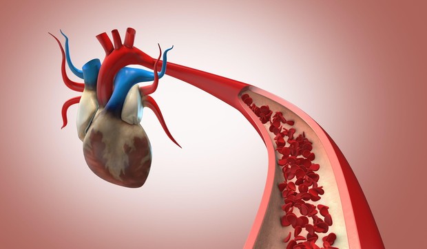 Vrednosti lipoproteina (a) su stabilne, pa jedan uzorak krvi daje doživotni odgovor na pitanje da li osoba nosi ovaj genetski rizik