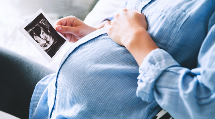 Babát vár a Jóban Rosszban színésznője, Papp Annamária / Illusztráció: iStock