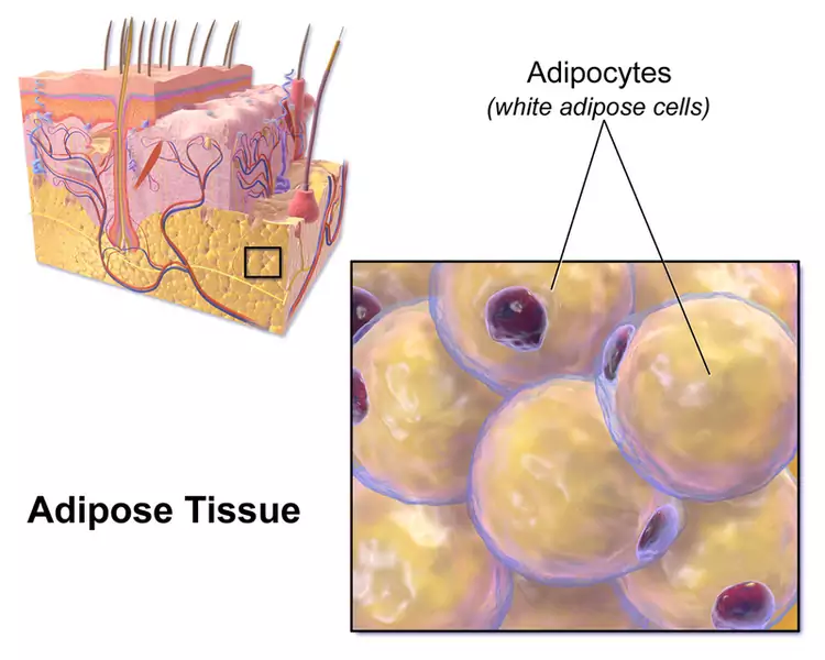 Budowa tkanki tłuszczowej i jej komórki. Podczas kriopolizy, której poddała się modelka, są zamrażane i &quot;rozpadają się&quot; pod wpływem zimna, dzięki czemu dana partia ciała może wyglądać szczuplej / Wikimedia Commons