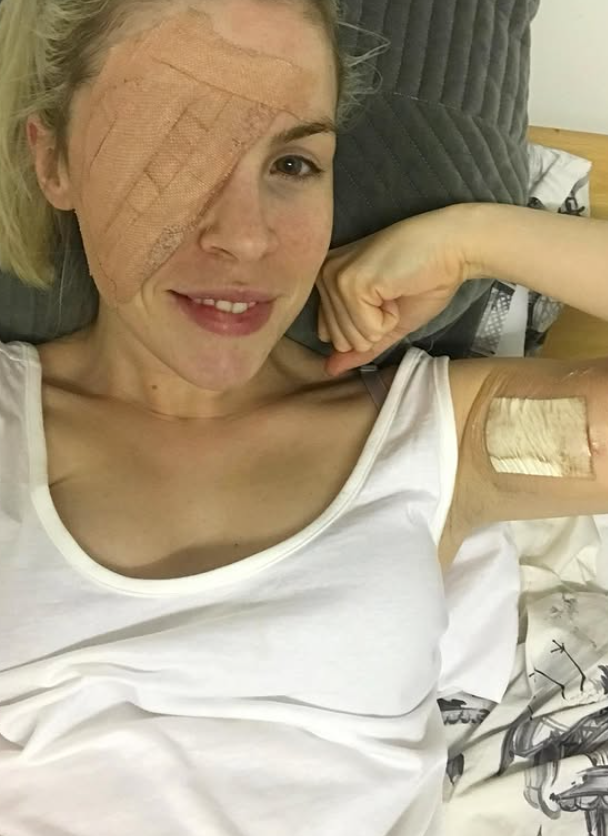 Lekár jej diagnostikoval rakovinu kože.