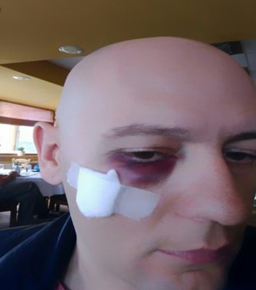 Pevač Šaćir Ameti udaren flašom u glavu