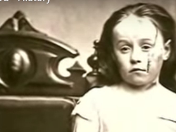 Zlostavljana devojčica