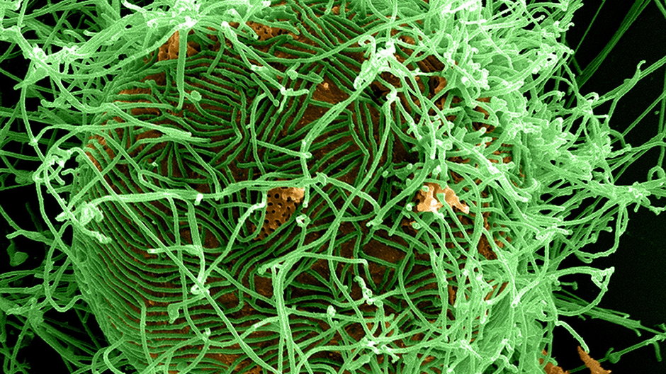 Komórka (pomarańczowa) zainfekowana przez Ebolę (zielona)