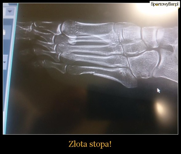 Justyna Kowalczyk - mem